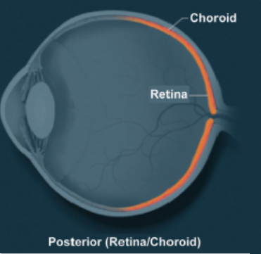 Uveítis posterior